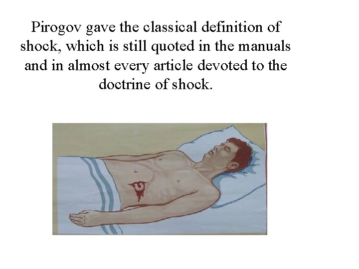 Pirogov gave the classical definition of shock, which is still quoted in the manuals Pirogov gave the classical definition of shock, which is still quoted in the manuals