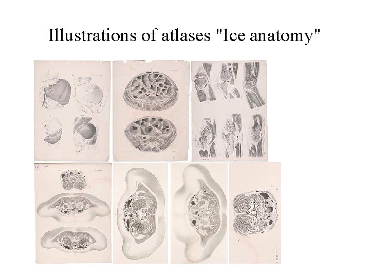 Illustrations of atlases "Ice anatomy" Illustrations of atlases "Ice anatomy"