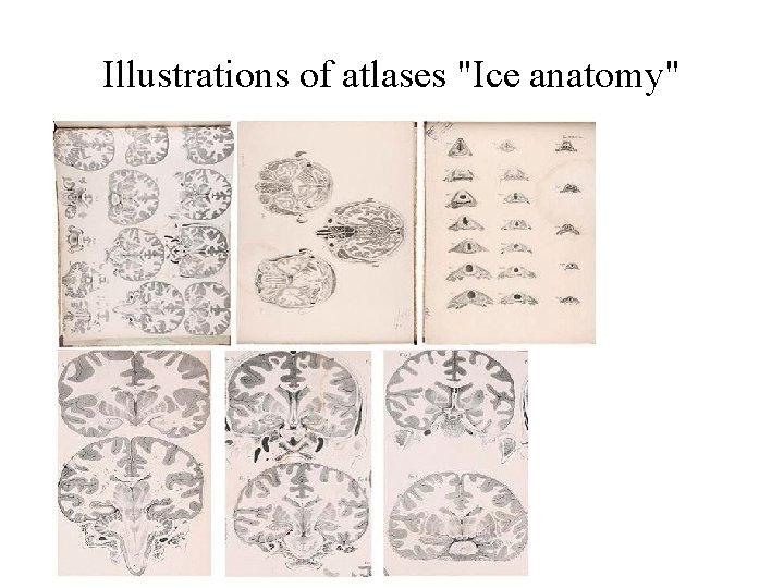 Illustrations of atlases "Ice anatomy" Illustrations of atlases "Ice anatomy"