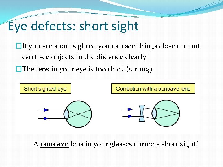 Eye defects: short sight �If you are short sighted you can see things close