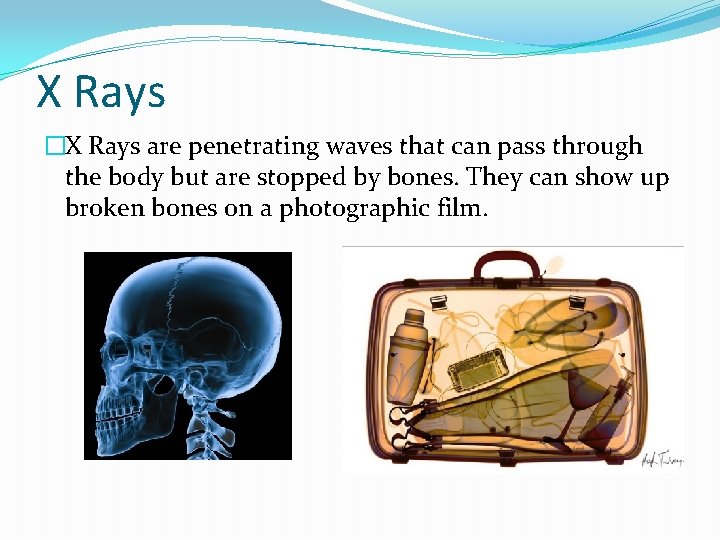 X Rays �X Rays are penetrating waves that can pass through the body but