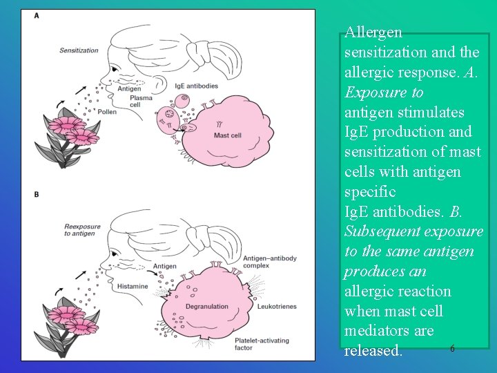 Allergen sensitization and the allergic response. A. Exposure to antigen stimulates Ig. E production