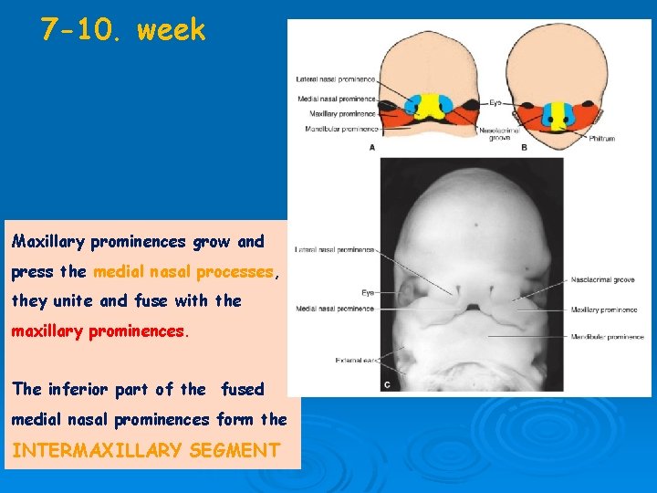 7 -10. week Maxillary prominences grow and press the medial nasal processes, they unite