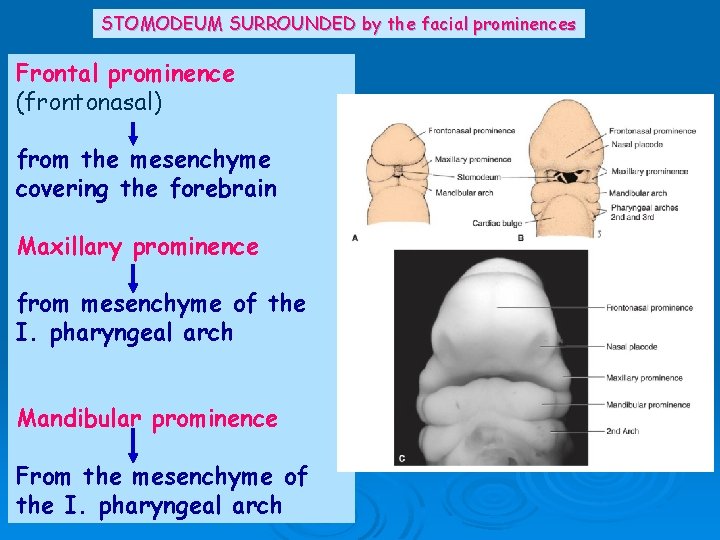 STOMODEUM SURROUNDED by the facial prominences Frontal prominence (frontonasal) from the mesenchyme covering the