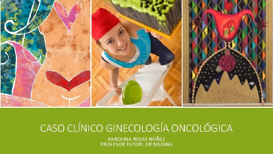 CASO CLÍNICO GINECOLOGÍA ONCOLÓGICA KAROLINA ROJAS NÚÑEZ PROFESOR TUTOR: DR MEDINA 