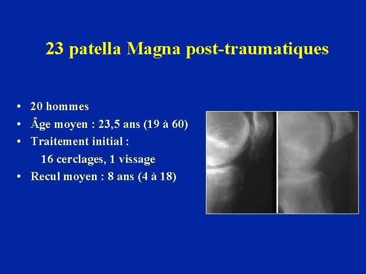 23 patella Magna post-traumatiques • 20 hommes • ge moyen : 23, 5 ans