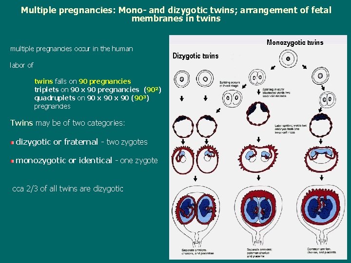 Multiple pregnancies: Mono- and dizygotic twins; arrangement of fetal membranes in twins multiple pregnancies