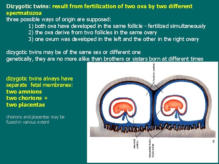 Dizygotic twins: result from fertilization of two ova by two different spermatozoa three possible