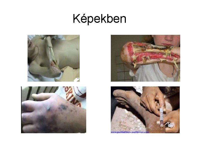 Képekben 