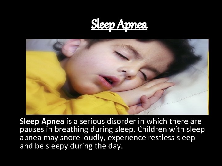 Sleep Apnea is a serious disorder in which there are pauses in breathing during