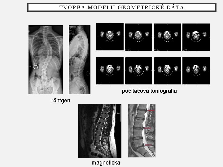 TVORBA MODELU-GEOMETRICKÉ DÁTA počítačová tomografia röntgen magnetická 