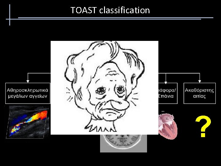 TOAST classification ? 