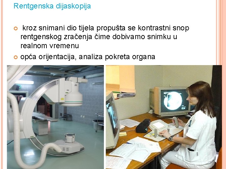 Rentgenska dijaskopija kroz snimani dio tijela propušta se kontrastni snop rentgenskog zračenja čime dobivamo