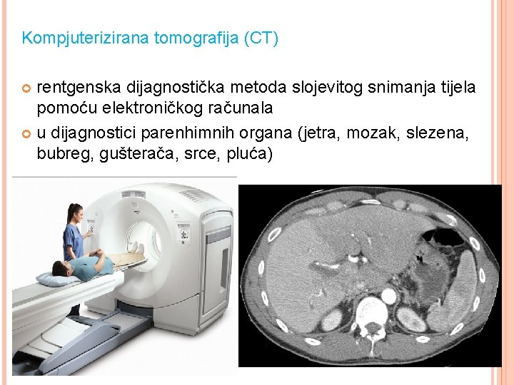 Kompjuterizirana tomografija (CT) rentgenska dijagnostička metoda slojevitog snimanja tijela pomoću elektroničkog računala u dijagnostici
