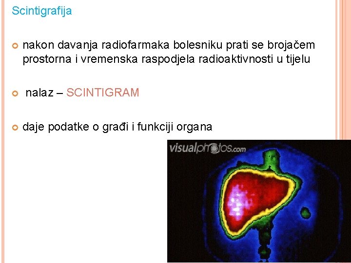 Scintigrafija nakon davanja radiofarmaka bolesniku prati se brojačem prostorna i vremenska raspodjela radioaktivnosti u