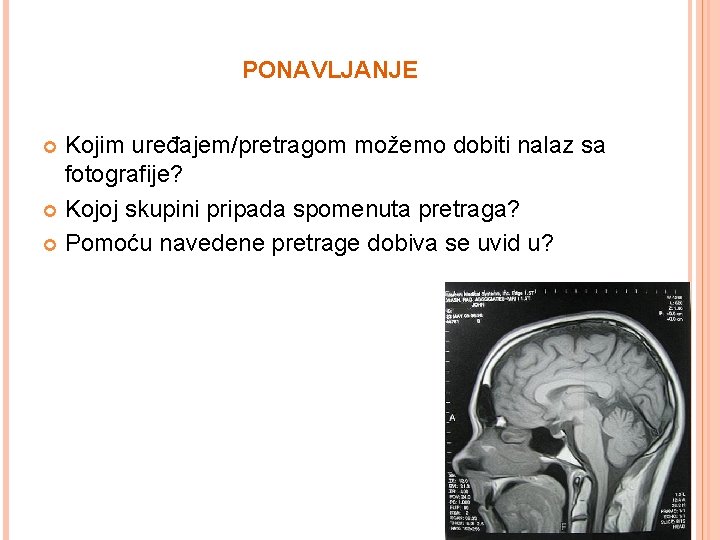 PONAVLJANJE Kojim uređajem/pretragom možemo dobiti nalaz sa fotografije? Kojoj skupini pripada spomenuta pretraga? Pomoću