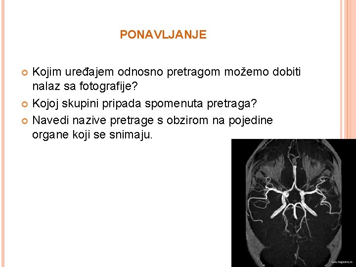 PONAVLJANJE Kojim uređajem odnosno pretragom možemo dobiti nalaz sa fotografije? Kojoj skupini pripada spomenuta PONAVLJANJE Kojim uređajem odnosno pretragom možemo dobiti nalaz sa fotografije? Kojoj skupini pripada spomenuta