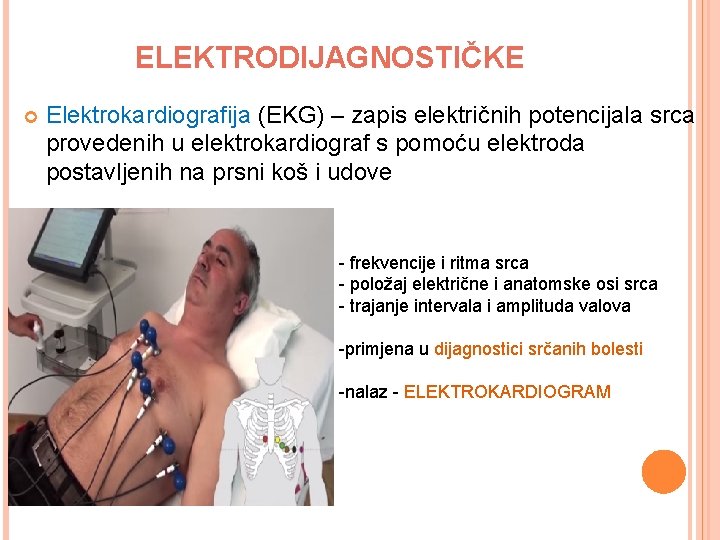 ELEKTRODIJAGNOSTIČKE Elektrokardiografija (EKG) – zapis električnih potencijala srca provedenih u elektrokardiograf s pomoću elektroda