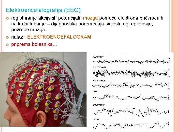 Elektroencefalografija (EEG) registriranje akcijskih potencijala mozga pomoću elektroda pričvršenih na kožu lubanje – dijagnostika