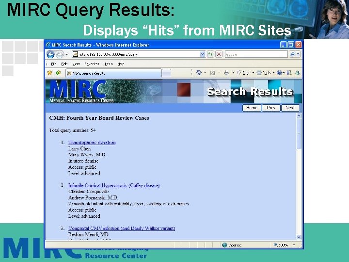 MIRC Query Results: Displays “Hits” from MIRC Sites 