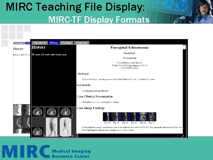 MIRC Teaching File Display: MIRC-TF Display Formats 