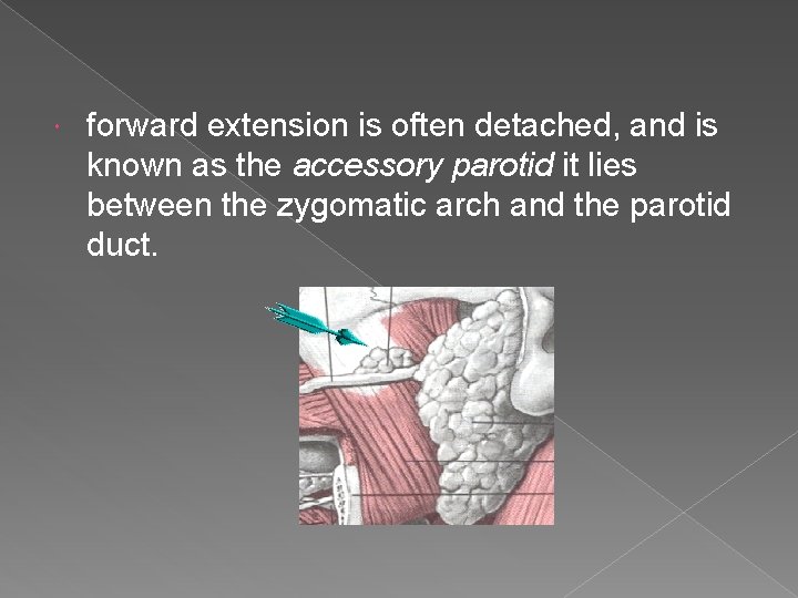 forward extension is often detached, and is known as the accessory parotid it forward extension is often detached, and is known as the accessory parotid it