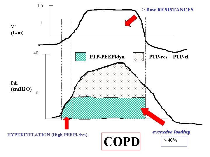 1. 0 > flow RESISTANCES 0 V’ (L/m) 40 PTP-PEEPidyn PTP-res + PTP-el Pdi