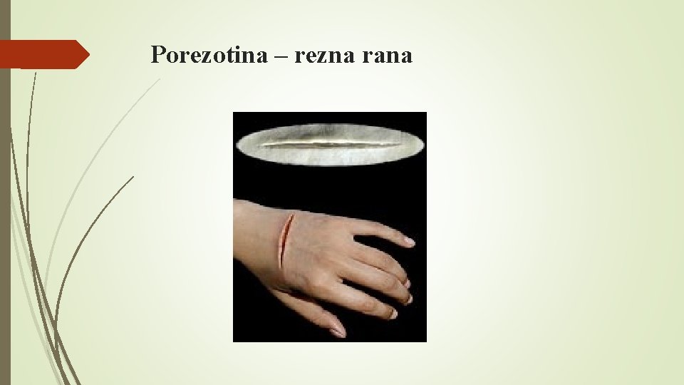 Porezotina – rezna rana Porezotina – rezna rana