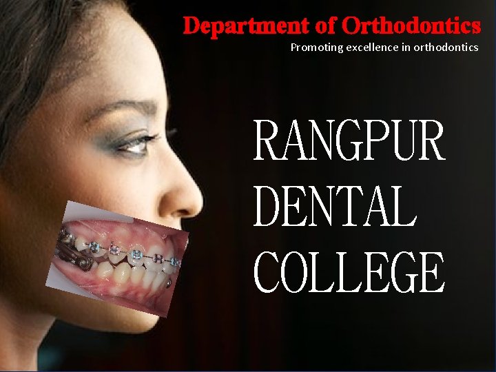 Department of Orthodontics Promoting excellence in orthodontics RANGPUR DENTAL COLLEGE 