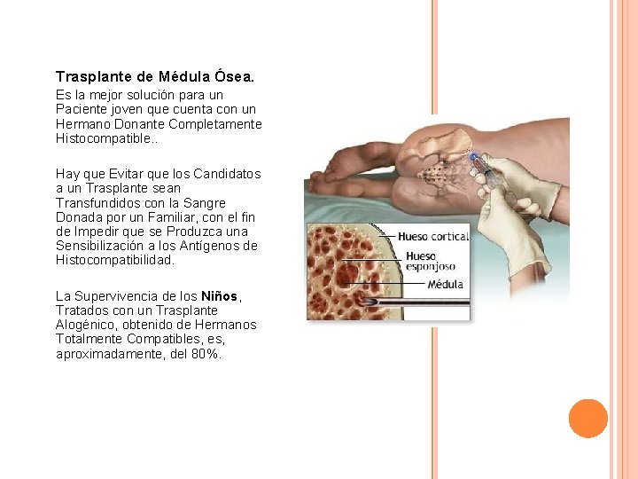 Trasplante de Médula Ósea. Es la mejor solución para un Paciente joven que cuenta