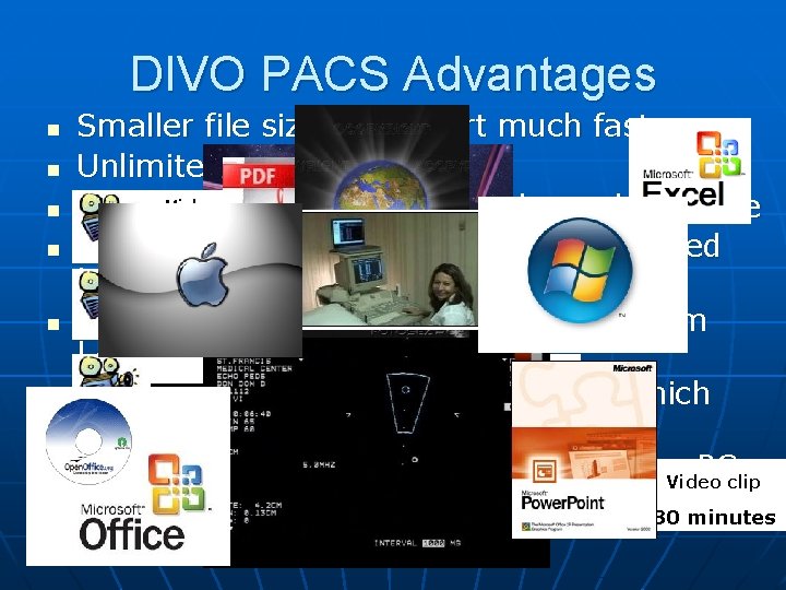 DIVO PACS Advantages n n n n Smaller file sizes transport much faster. Unlimited