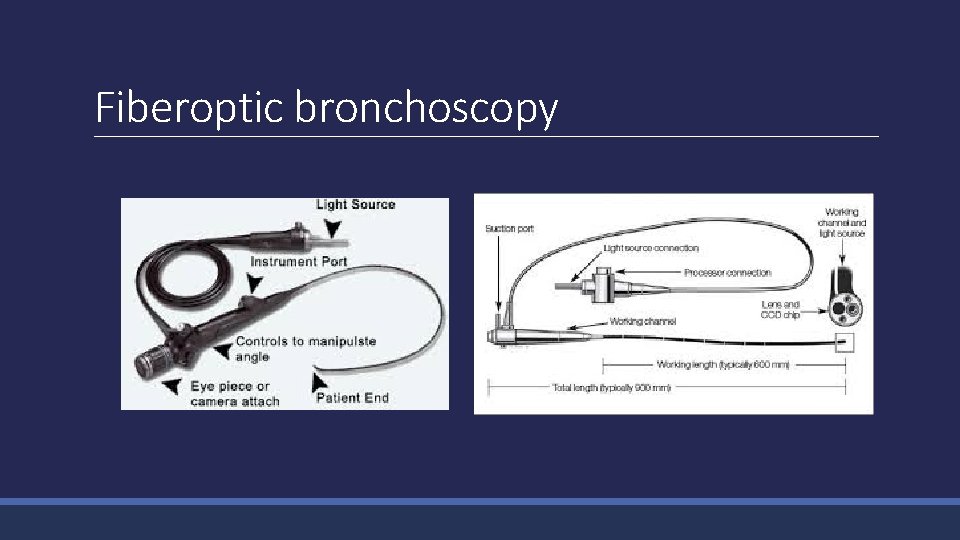 Fiberoptic bronchoscopy 