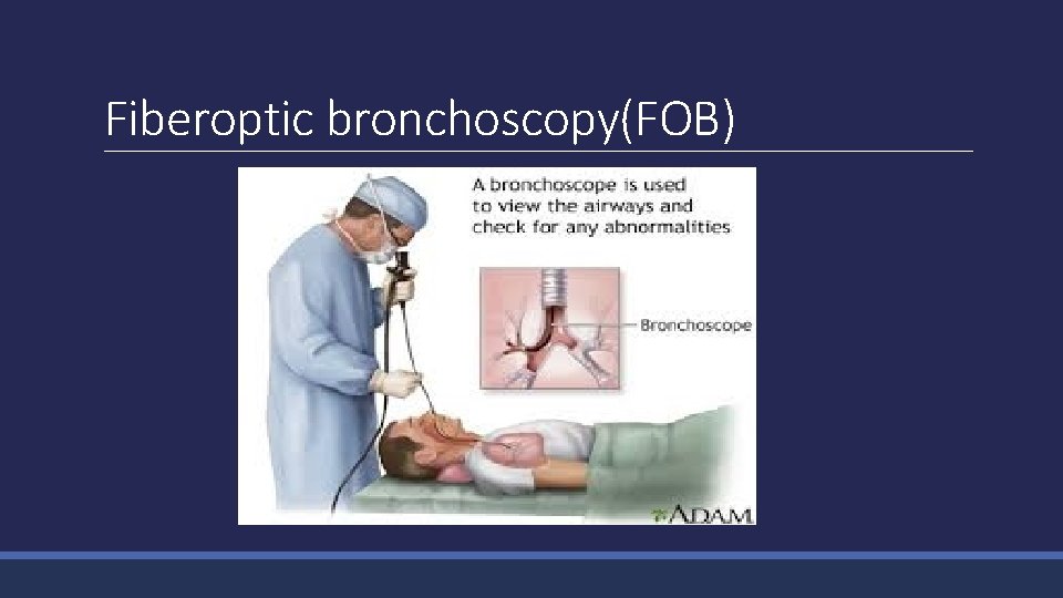 Fiberoptic bronchoscopy(FOB) 