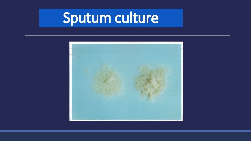 Sputum culture 