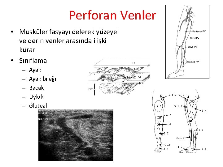 Perforan Venler • Musküler fasyayı delerek yüzeyel ve derin venler arasında ilişki kurar • Perforan Venler • Musküler fasyayı delerek yüzeyel ve derin venler arasında ilişki kurar •