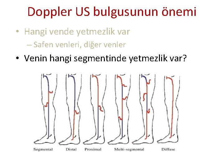Doppler US bulgusunun önemi • Hangi vende yetmezlik var – Safen venleri, diğer venler Doppler US bulgusunun önemi • Hangi vende yetmezlik var – Safen venleri, diğer venler