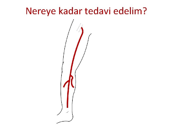 Nereye kadar tedavi edelim? Nereye kadar tedavi edelim?