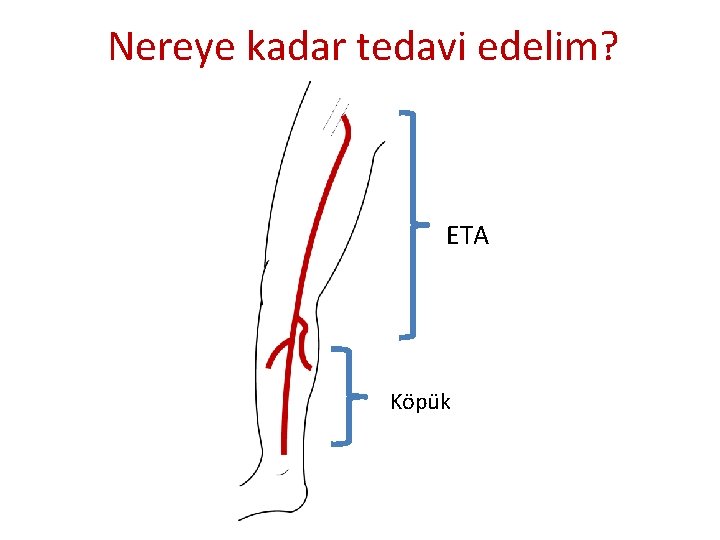 Nereye kadar tedavi edelim? ETA Köpük Nereye kadar tedavi edelim? ETA Köpük