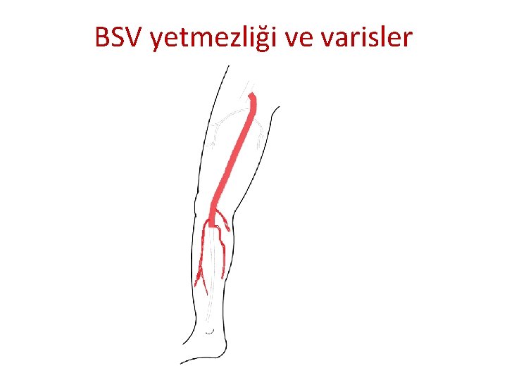 BSV yetmezliği ve varisler BSV yetmezliği ve varisler