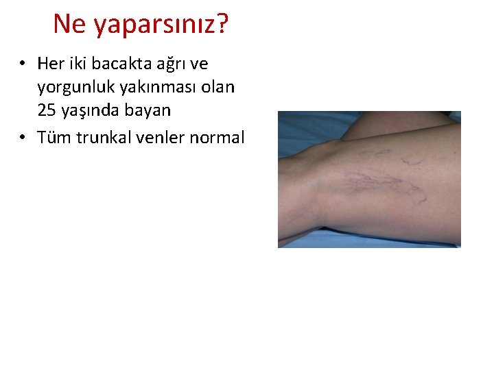 Ne yaparsınız? • Her iki bacakta ağrı ve yorgunluk yakınması olan 25 yaşında bayan Ne yaparsınız? • Her iki bacakta ağrı ve yorgunluk yakınması olan 25 yaşında bayan