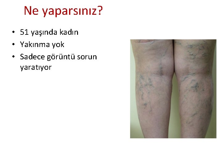 Ne yaparsınız? • 51 yaşında kadın • Yakınma yok • Sadece görüntü sorun yaratıyor Ne yaparsınız? • 51 yaşında kadın • Yakınma yok • Sadece görüntü sorun yaratıyor