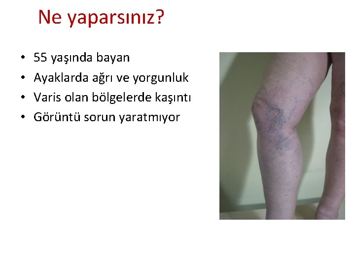 Ne yaparsınız? • • 55 yaşında bayan Ayaklarda ağrı ve yorgunluk Varis olan bölgelerde Ne yaparsınız? • • 55 yaşında bayan Ayaklarda ağrı ve yorgunluk Varis olan bölgelerde