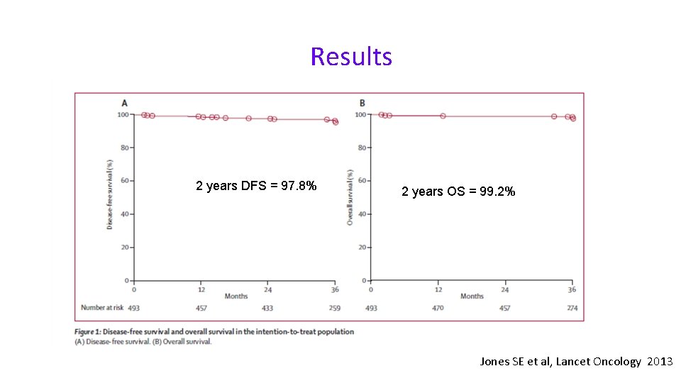 Results 2 years DFS = 97. 8% 2 years OS = 99. 2% Jones