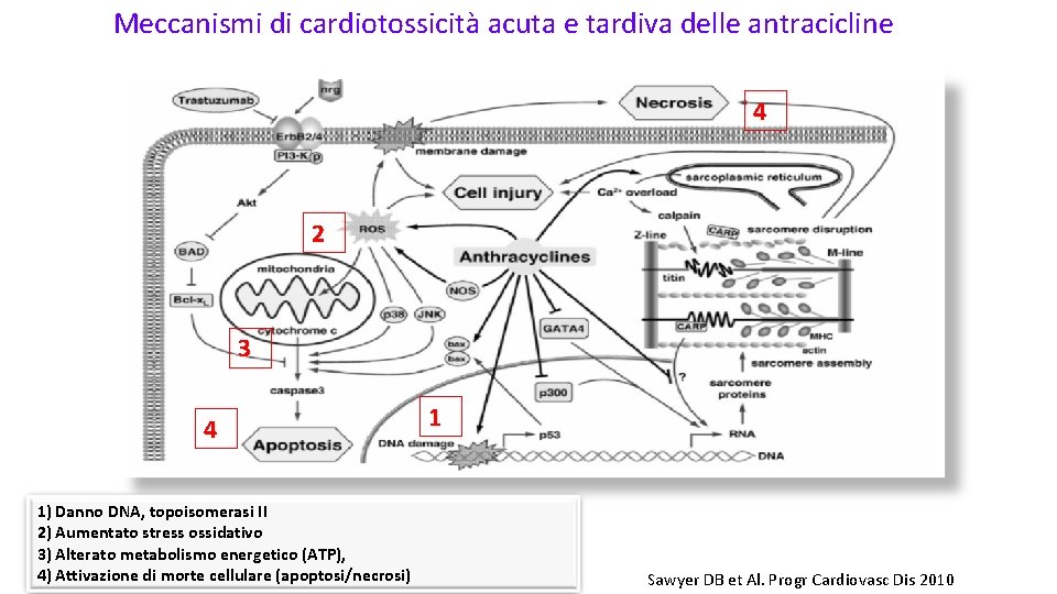 Meccanismi di cardiotossicità acuta e tardiva delle antracicline 4 2 3 4 1) Danno