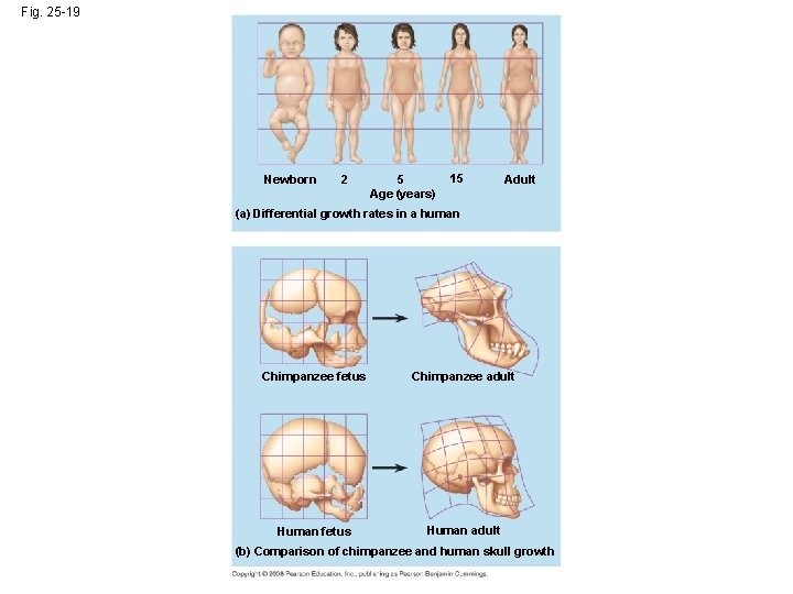 Fig. 25 -19 Newborn 2 5 Age (years) 15 Adult (a) Differential growth rates