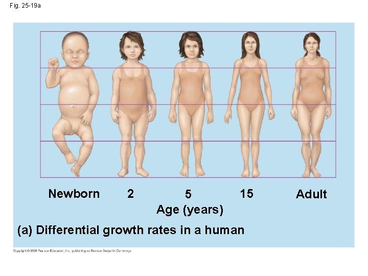 Fig. 25 -19 a Newborn 2 5 Age (years) 15 (a) Differential growth rates