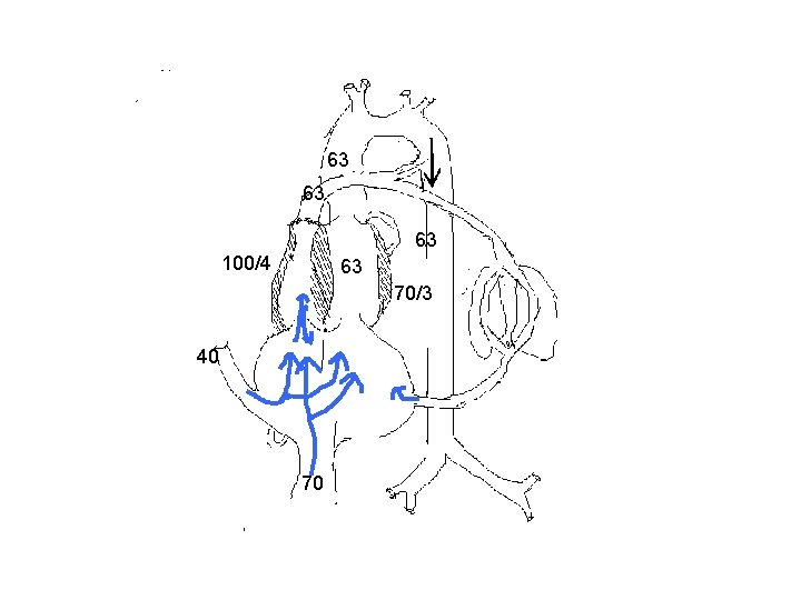 63 63 63 100/4 63 70/3 40 70 