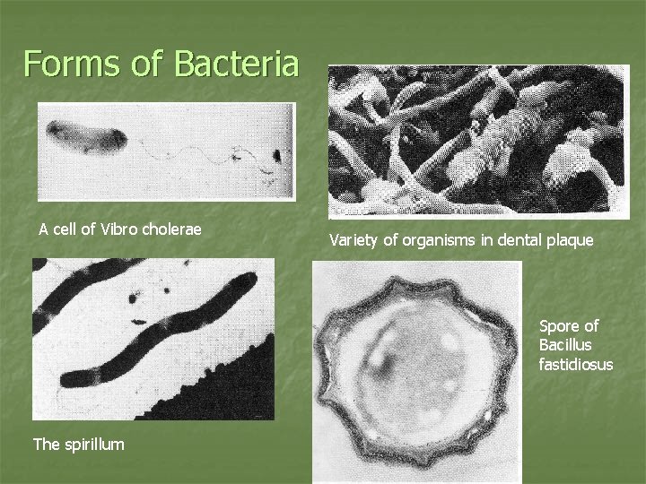 Forms of Bacteria A cell of Vibro cholerae Variety of organisms in dental plaque