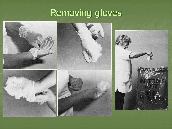 Removing gloves 