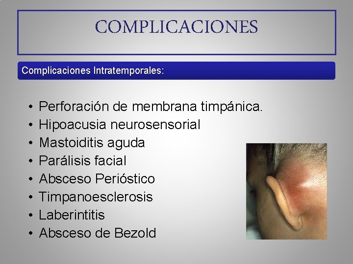 COMPLICACIONES Complicaciones Intratemporales: Complicaciones Intratemporales • • Perforación de membrana timpánica. Hipoacusia neurosensorial Mastoiditis
